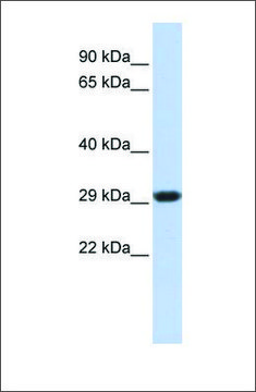 Anti-SDHB antibody produced in rabbit affinity isolated antibody