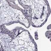 Anti-NME5 antibody produced in rabbit Prestige Antibodies&#174; Powered by Atlas Antibodies, affinity isolated antibody, buffered aqueous glycerol solution