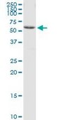 Anti-CCT8 antibody produced in mouse purified immunoglobulin, buffered aqueous solution