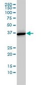 Monoclonal Anti-ANXA2, (C-terminal) antibody produced in mouse clone 1G7, purified immunoglobulin, buffered aqueous solution