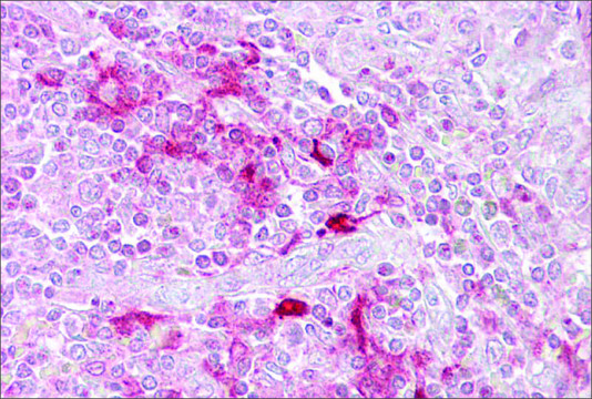 Anti-ETV5 (AB1) antibody produced in rabbit affinity isolated antibody