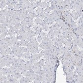 Anti-B3GNT7 antibody produced in rabbit Prestige Antibodies&#174; Powered by Atlas Antibodies, affinity isolated antibody, buffered aqueous glycerol solution