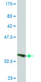 Monoclonal Anti-ACP5 antibody produced in mouse clone 2D9, purified immunoglobulin, buffered aqueous solution