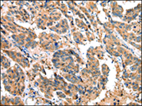 Anti-EPHA2 affinity isolated antibody