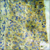 Anti-phospho-CRYAB/Crystallin-&#945;-B (pSer59) antibody produced in rabbit affinity isolated antibody
