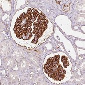 Monoclonal Anti-PODXL antibody produced in mouse clone CL0284, purified immunoglobulin, buffered aqueous glycerol solution
