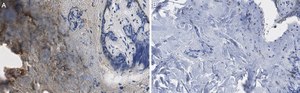 Anti-Collagen Type III Antibody, clone 3N18 ZooMAb&#174; Rabbit Monoclonal recombinant, expressed in HEK 293 cells