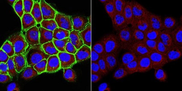 Anti-UDP-Galactose Transporter Antibody, clone 1H10.1 clone 1H10.1, from mouse