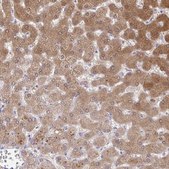 Anti-NNMT antibody produced in rabbit Prestige Antibodies&#174; Powered by Atlas Antibodies, affinity isolated antibody, buffered aqueous glycerol solution