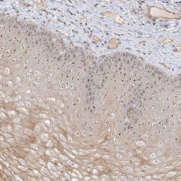 Anti-DDX18 antibody produced in rabbit Prestige Antibodies&#174; Powered by Atlas Antibodies, affinity isolated antibody, buffered aqueous glycerol solution