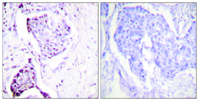 Anti-Ubiquitin antibody produced in rabbit affinity isolated antibody