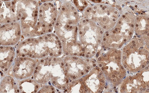 Anti-RABL3 Antibody, clone 1C2 ZooMAb&#174; Rabbit Monoclonal recombinant, expressed in HEK 293 cells