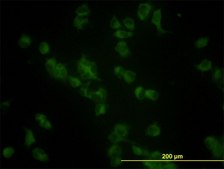 Monoclonal Anti-GBA antibody produced in mouse clone 2e2, purified immunoglobulin, buffered aqueous solution
