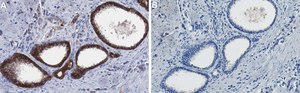 Anti-CXADR/CAR Antibody, clone 1D19 ZooMAb&#174; Rabbit Monoclonal recombinant, expressed in HEK 293 cells