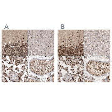 Anti-CBLL1 antibody produced in rabbit Prestige Antibodies&#174; Powered by Atlas Antibodies, affinity isolated antibody, buffered aqueous glycerol solution, Ab2