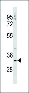 ANTI-TMEM178 (CENTER) antibody produced in rabbit IgG fraction of antiserum, buffered aqueous solution