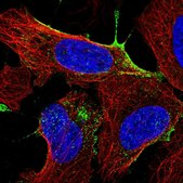 Anti-ANKRD13B antibody produced in rabbit Prestige Antibodies&#174; Powered by Atlas Antibodies, affinity isolated antibody, buffered aqueous glycerol solution