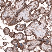 Anti-TMEM2 antibody produced in rabbit Prestige Antibodies&#174; Powered by Atlas Antibodies, affinity isolated antibody, buffered aqueous glycerol solution