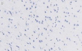 Anti-GAD67 Antibody, clone 1G10.2 ZooMAb&#174; Mouse Monoclonal recombinant, expressed in HEK 293 cells