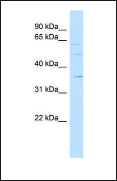 Anti-SLC22A17 antibody produced in rabbit affinity isolated antibody