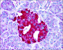 Anti-GLUD1 affinity isolated antibody