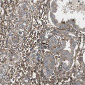 Anti-DDAH2 antibody produced in rabbit Prestige Antibodies&#174; Powered by Atlas Antibodies, affinity isolated antibody, buffered aqueous glycerol solution