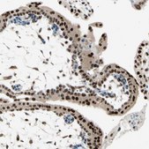Anti-RNF43 antibody produced in rabbit Prestige Antibodies&#174; Powered by Atlas Antibodies, affinity isolated antibody, buffered aqueous glycerol solution
