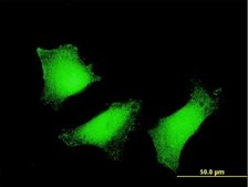 Monoclonal Anti-TGM2 antibody produced in mouse clone 2F4, purified immunoglobulin, buffered aqueous solution
