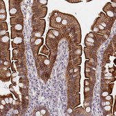 Anti-DAB1 antibody produced in rabbit Prestige Antibodies&#174; Powered by Atlas Antibodies, affinity isolated antibody, buffered aqueous glycerol solution