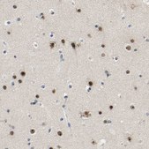 Anti-NOP58 antibody produced in rabbit Prestige Antibodies&#174; Powered by Atlas Antibodies, affinity isolated antibody, buffered aqueous glycerol solution