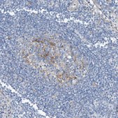 Anti-TNS2 antibody produced in rabbit Prestige Antibodies&#174; Powered by Atlas Antibodies, affinity isolated antibody, buffered aqueous glycerol solution