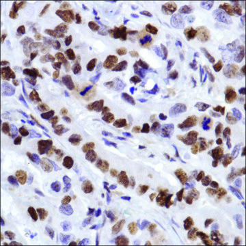 Anti-MCM2 antibody, Rabbit monoclonal clone SP85, recombinant, expressed in proprietary host, affinity isolated antibody