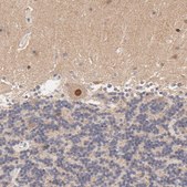Anti-TXNL1 antibody produced in rabbit Prestige Antibodies&#174; Powered by Atlas Antibodies, affinity isolated antibody, buffered aqueous glycerol solution