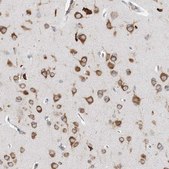 Anti-LARP4B antibody produced in rabbit Prestige Antibodies&#174; Powered by Atlas Antibodies, affinity isolated antibody, buffered aqueous glycerol solution