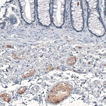 Anti-CXCL8 antibody produced in rabbit Prestige Antibodies&#174; Powered by Atlas Antibodies, affinity isolated antibody, buffered aqueous glycerol solution