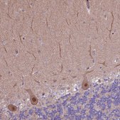 Anti-HDAC5 antibody produced in rabbit Prestige Antibodies&#174; Powered by Atlas Antibodies, affinity isolated antibody, buffered aqueous glycerol solution