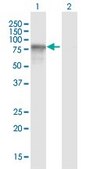 Anti-OPTN antibody produced in mouse purified immunoglobulin, buffered aqueous solution