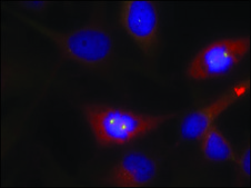 Anti-CTNNB1 (Ab-33) antibody produced in rabbit affinity isolated antibody