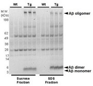 Anti-phospho-Amyloid beta Antibody (Ser26), clone 5H11C10 clone 5H11C10, from mouse