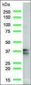 Anti-Nucleophosmin antibody, Rabbit monoclonal recombinant, expressed in proprietary host, clone SP236, affinity isolated antibody