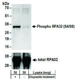 Rabbit anti-Phospho RPA32 (S4/S8) Antibody, Affinity Purified Powered by Bethyl Laboratories, Inc.