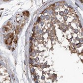 Anti-ASCC3 antibody produced in rabbit Prestige Antibodies&#174; Powered by Atlas Antibodies, affinity isolated antibody, buffered aqueous glycerol solution, ab3