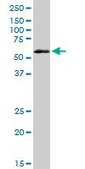 Anti-VRK2 antibody produced in rabbit purified immunoglobulin, buffered aqueous solution