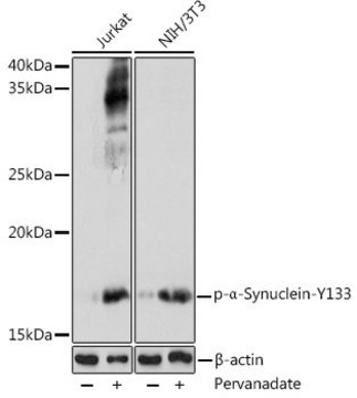 Anti-Phospho-&#945;-Synuclein-Y133 antibody produced in rabbit