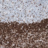 Monoclonal Anti-BCL2 antibody produced in mouse Prestige Antibodies&#174; Powered by Atlas Antibodies, clone CL7935, purified immunoglobulin, buffered aqueous glycerol solution