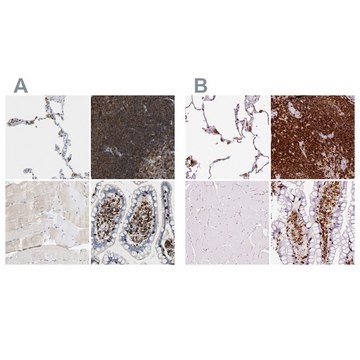 Anti-EVL antibody produced in rabbit Prestige Antibodies&#174; Powered by Atlas Antibodies, affinity isolated antibody, buffered aqueous glycerol solution