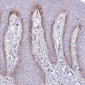 Anti-COL17A1 antibody produced in rabbit Prestige Antibodies&#174; Powered by Atlas Antibodies, affinity isolated antibody, buffered aqueous glycerol solution