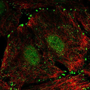 Anti-LIMD1 antibody produced in rabbit Prestige Antibodies&#174; Powered by Atlas Antibodies, affinity isolated antibody