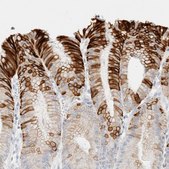 Anti-KRT20 antibody produced in rabbit Prestige Antibodies&#174; Powered by Atlas Antibodies, affinity isolated antibody, buffered aqueous glycerol solution, Ab1