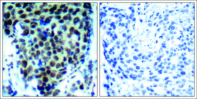 Anti-phospho-MAPK14 (pThr180) antibody produced in rabbit affinity isolated antibody